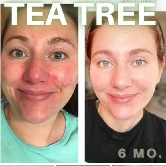 Dr. C. Tuna Tea Tree Face Cream NIP - Picture 6 of 7